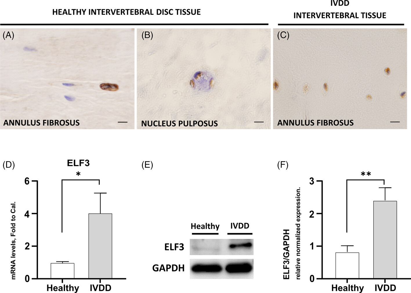 E74-like ETS transcription factor 3 expression and regulation in human intervertebral disc