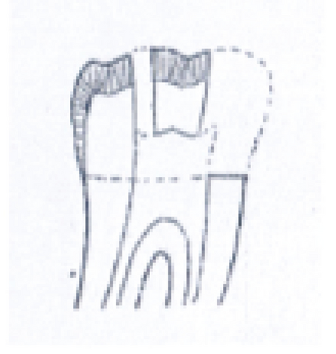 Details are in the caption following the image
