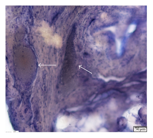 Details are in the caption following the image