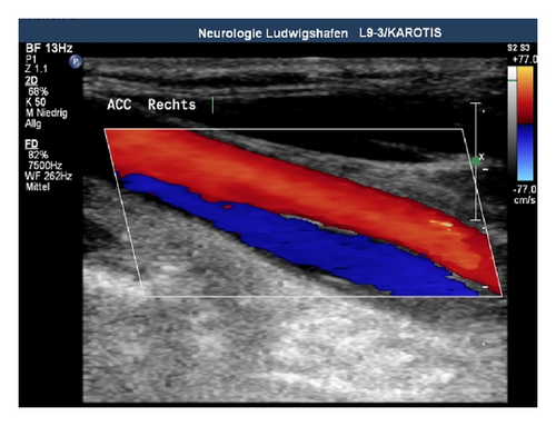 Details are in the caption following the image Details are in the caption following the image