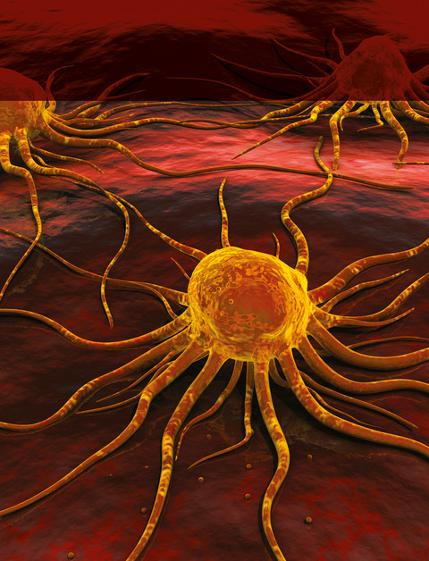 Nonsteroidal anti-inflammatory drugs (NSAIDs) and prostate cancer risk: results from the EPICAP study