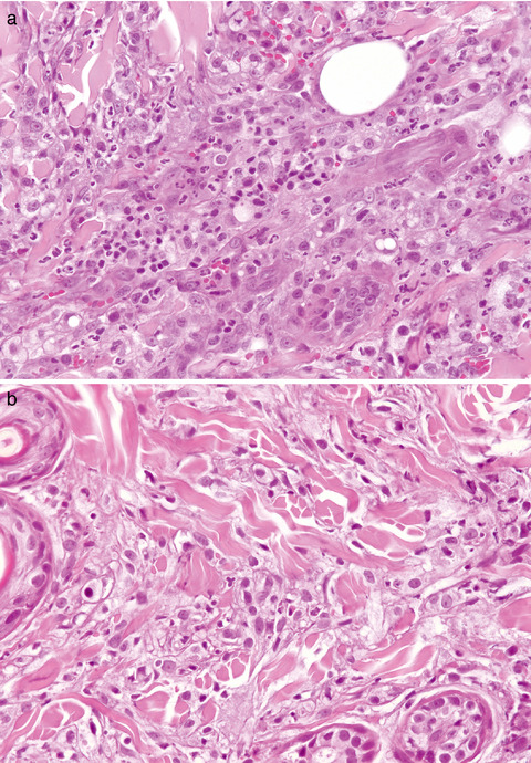 A retrospective histopathological, immunohistochemical and molecular study of the presence of Leishmania spp. in the skin of cats with head and neck ulcerative dermatitis