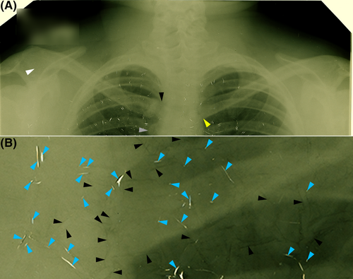 Details are in the caption following the image