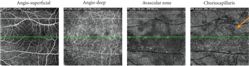 Details are in the caption following the image Details are in the caption following the image