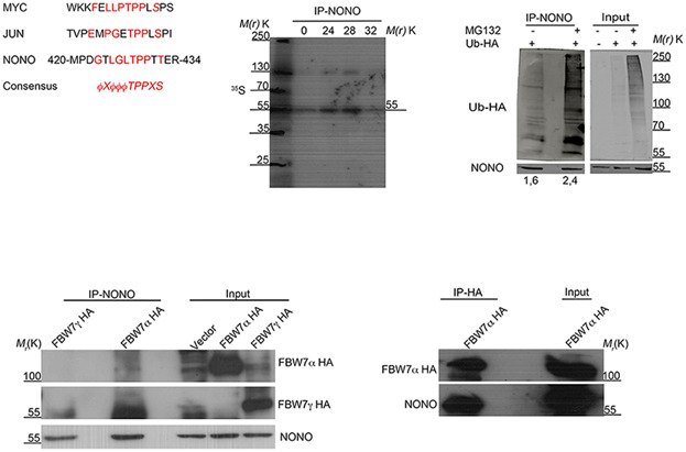 NONO ubiquitination is mediated by FBW7 and GSK3 β via a degron lost upon chromosomal rearrangement in cancer