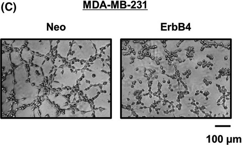 ErbB4-mediated regulation of vasculogenic mimicry capability in breast cancer cells