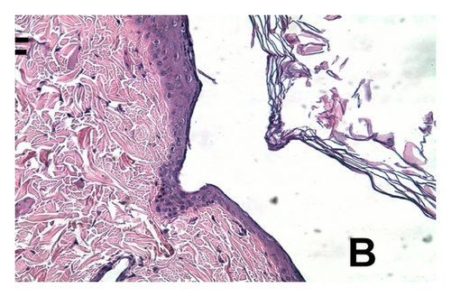 Details are in the caption following the image