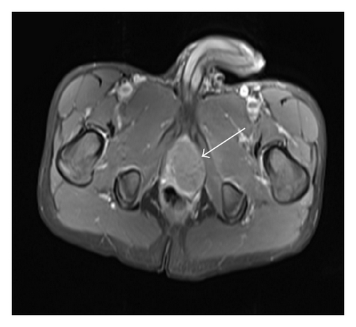 Details are in the caption following the image