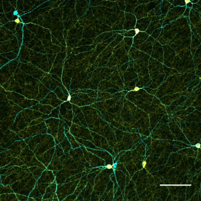 Distribution and diversity of intrinsically photosensitive retinal ganglion cells in tree shrew