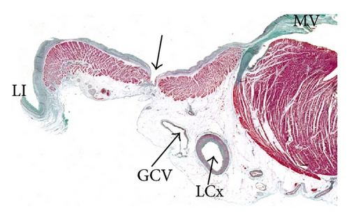 Details are in the caption following the image