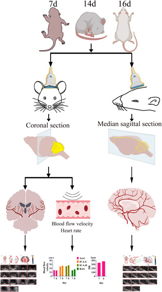 Normal cerebral blood vessels under ultrasound in SD rats of different ages