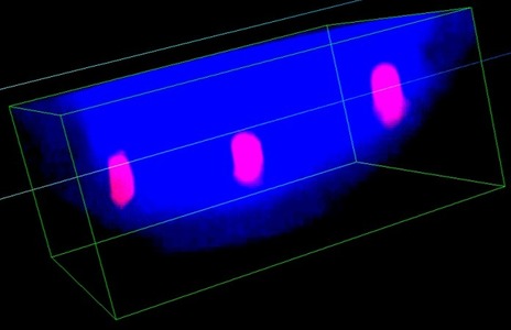 Intracellular localization and delivery of plasmid DNA by biodegradable microsphere-mediated femtosecond laser optoporation