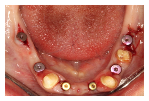 Details are in the caption following the image Details are in the caption following the image