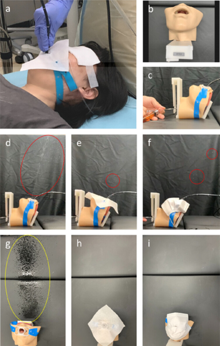 Novel device to prevent droplets in bronchoscopy during the SARS-CoV-2 pandemic