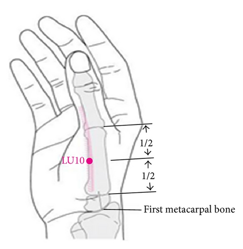 Details are in the caption following the image