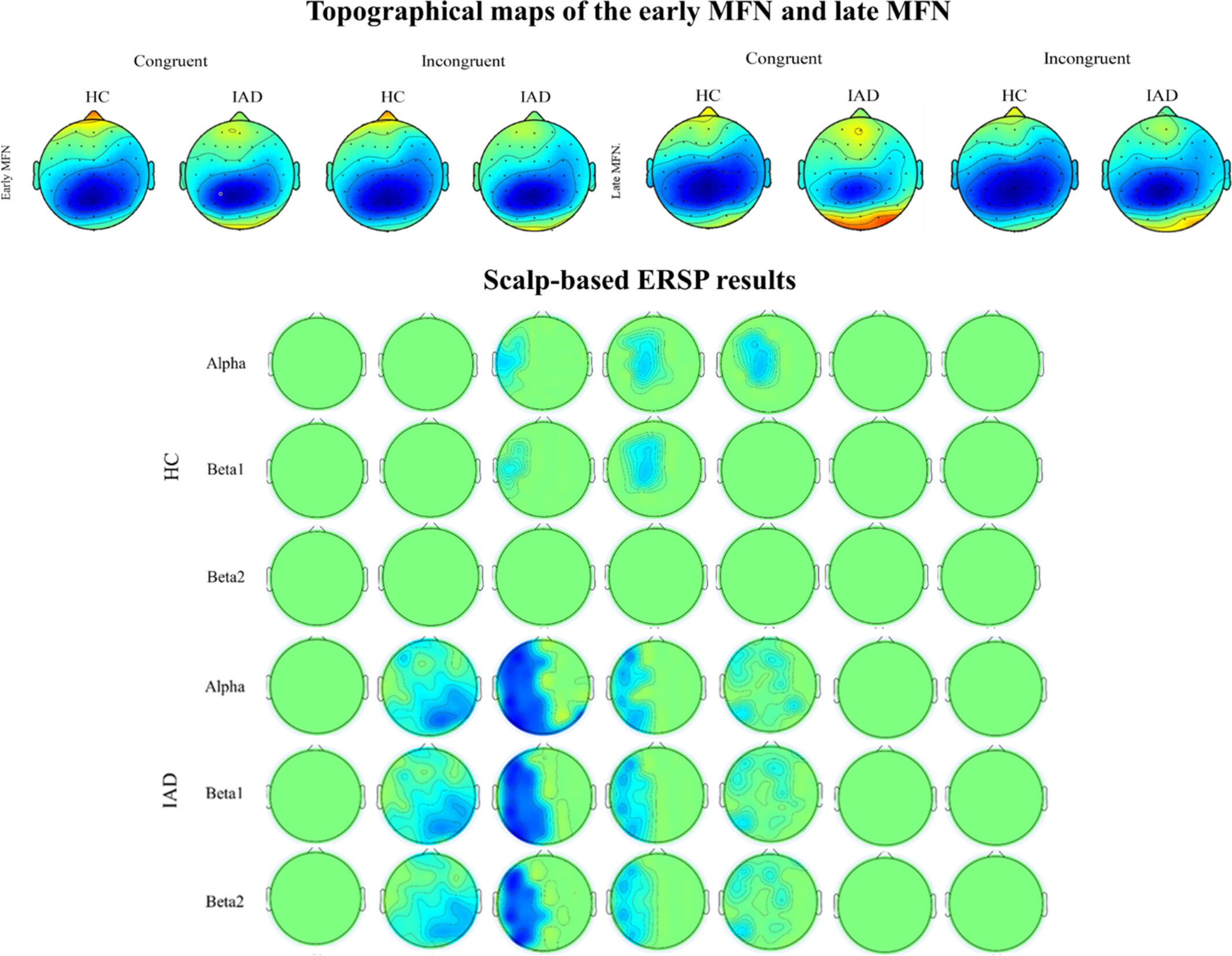 Impaired Interference Control in Individuals With Internet Addiction: Evidence From Event-Related Potentials and Brain Oscillations