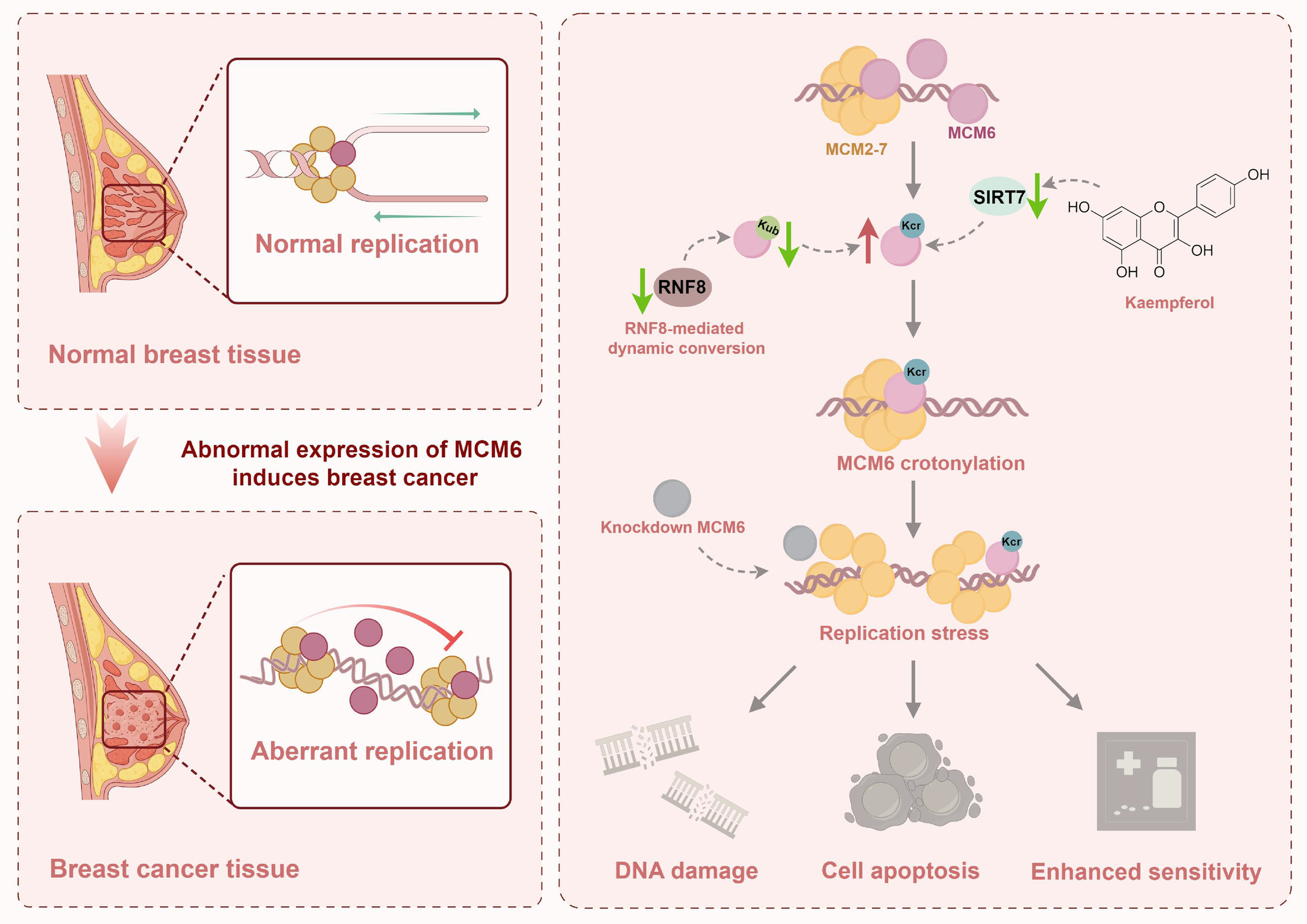 Crotonylation of MCM6 enhances chemotherapeutics sensitivity of breast cancer via inducing DNA replication stress