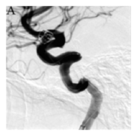 Details are in the caption following the image