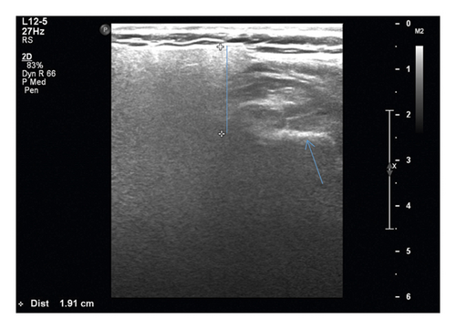 Details are in the caption following the image