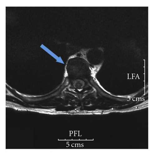 Details are in the caption following the image