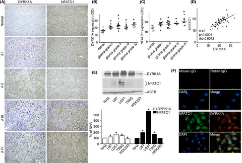 DYRK1A activates NFATC1 to increase glioblastoma migration