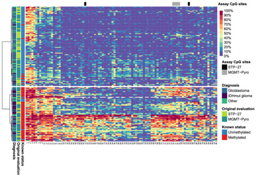 Accurate and comprehensive evaluation of O6-methylguanine-DNA methyltransferase promoter methylation by nanopore sequencing
