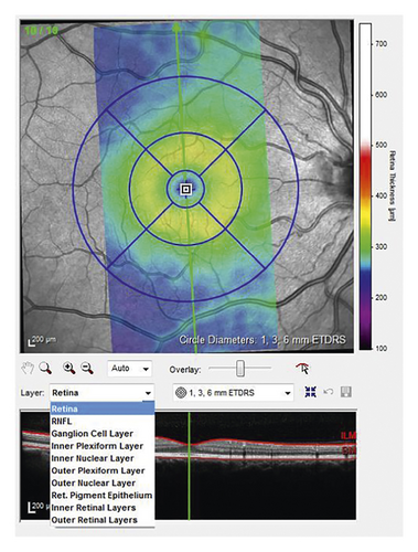Details are in the caption following the image Details are in the caption following the image