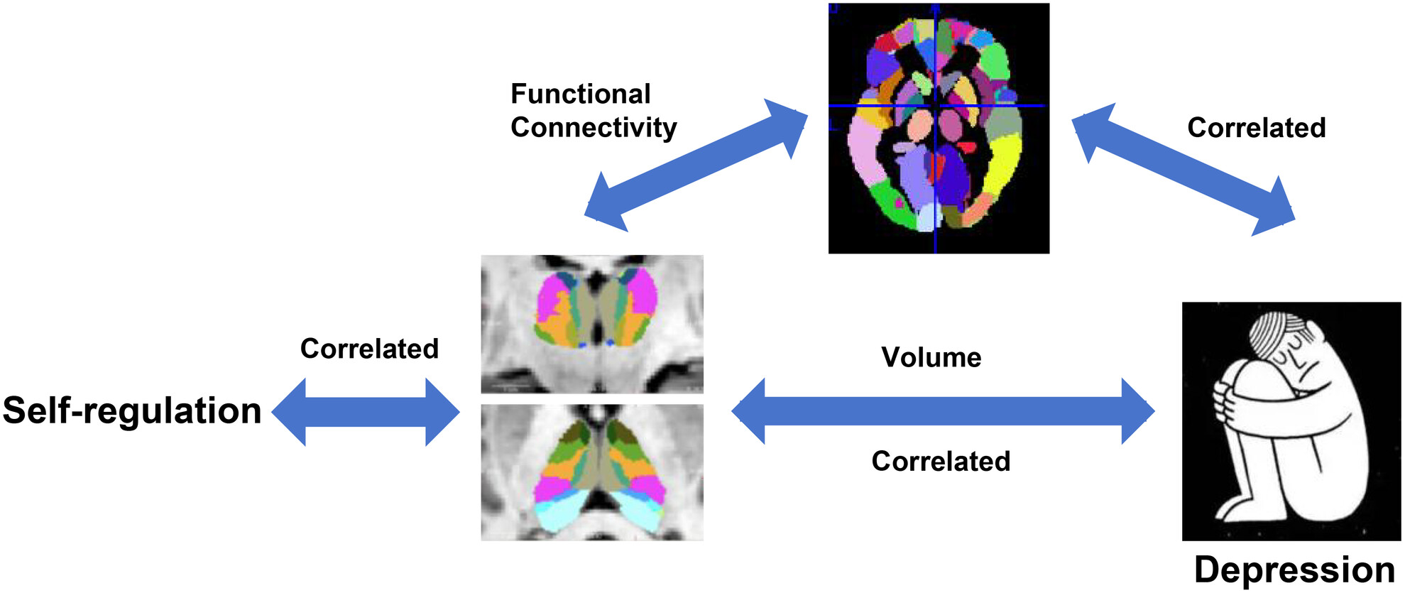 Thalamic Volumes and Functional Networks Linked With Self-Regulation Dysfunction in Major Depressive Disorder