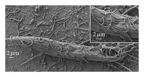 Details are in the caption following the image