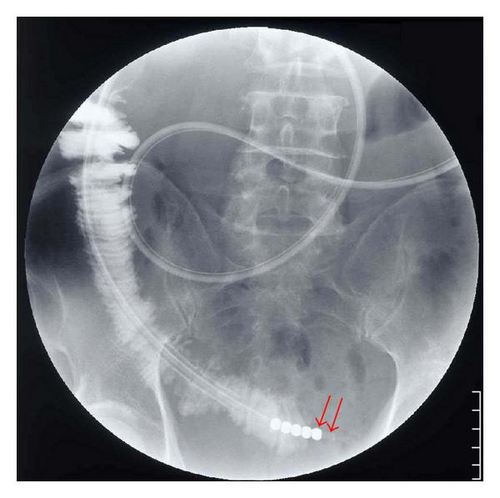 Details are in the caption following the image Details are in the caption following the image