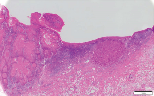 Details are in the caption following the image