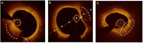 Details are in the caption following the image Details are in the caption following the image