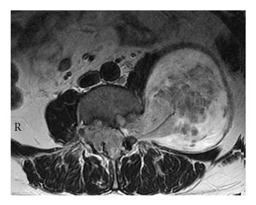 Details are in the caption following the image