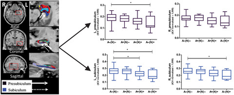 Hippocampal subregional volume changes in elders classified using positron emission tomography-based Alzheimer's biomarkers of β-amyloid deposition and neurodegeneration