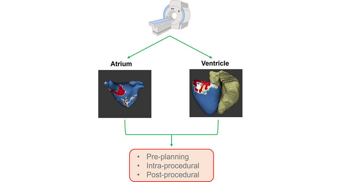 Ablation of Ventricular and Atrial Arrhythmias in the Era of Cardiac Magnetic Resonance