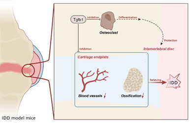 TGF-β1 Inhibits Osteoclast Differentiation and Abnormal Angiogenesis in Intervertebral Disc Degeneration: Evidence from RNA Sequencing and Animal Studies