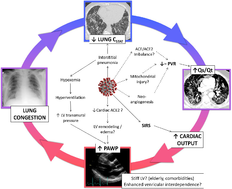 Haemodynamic characteristics of COVID-19 patients with acute respiratory distress syndrome requiring mechanical ventilation. An invasive assessment using right heart catheterization