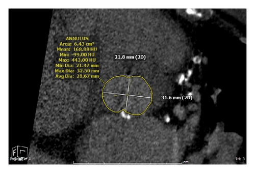 Details are in the caption following the image