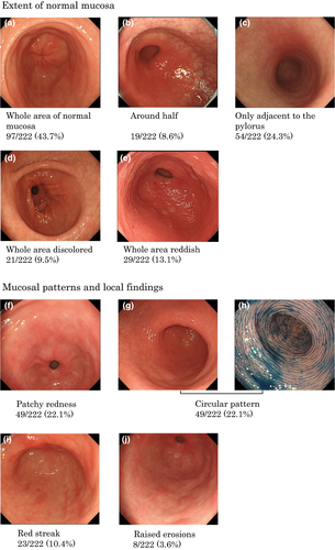 Details are in the caption following the image Details are in the caption following the image