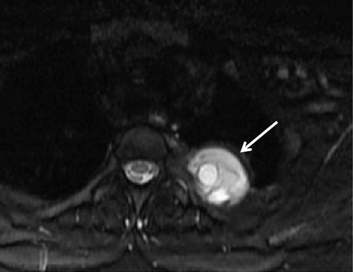 Details are in the caption following the image