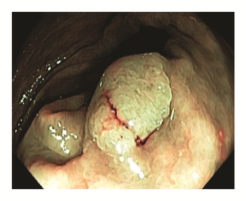 Details are in the caption following the image Details are in the caption following the image