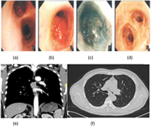 Details are in the caption following the image Details are in the caption following the image