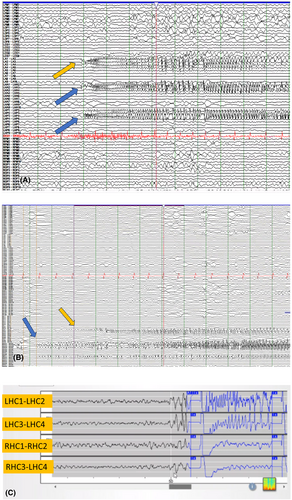 Details are in the caption following the image Details are in the caption following the image