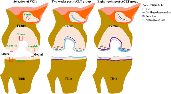 Early changes in osteochondral tissues in a rabbit model of post-traumatic osteoarthritis