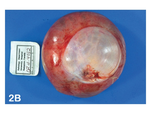Details are in the caption following the image Details are in the caption following the image