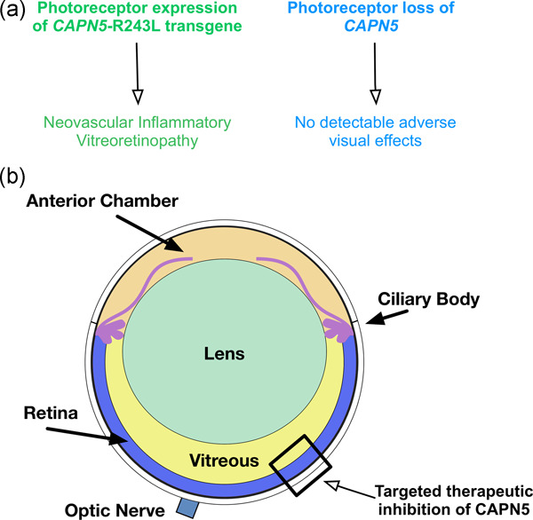 CAPN5 genetic inactivation phenotype supports therapeutic inhibition trials