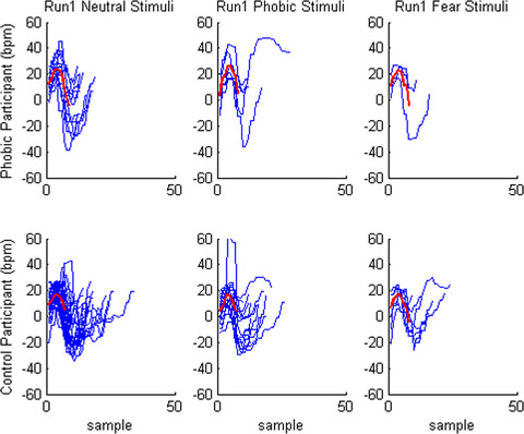 The feasibility of an augment reality system to study the psychophysiological correlates of fear-related responses