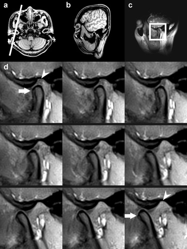 Details are in the caption following the image Details are in the caption following the image