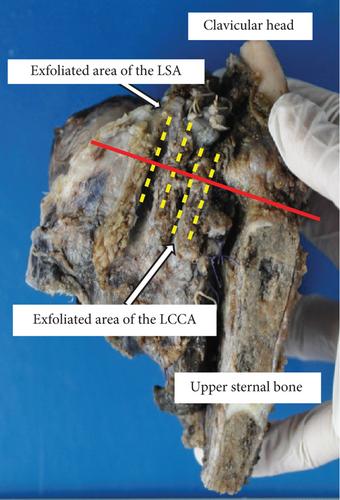 Details are in the caption following the image