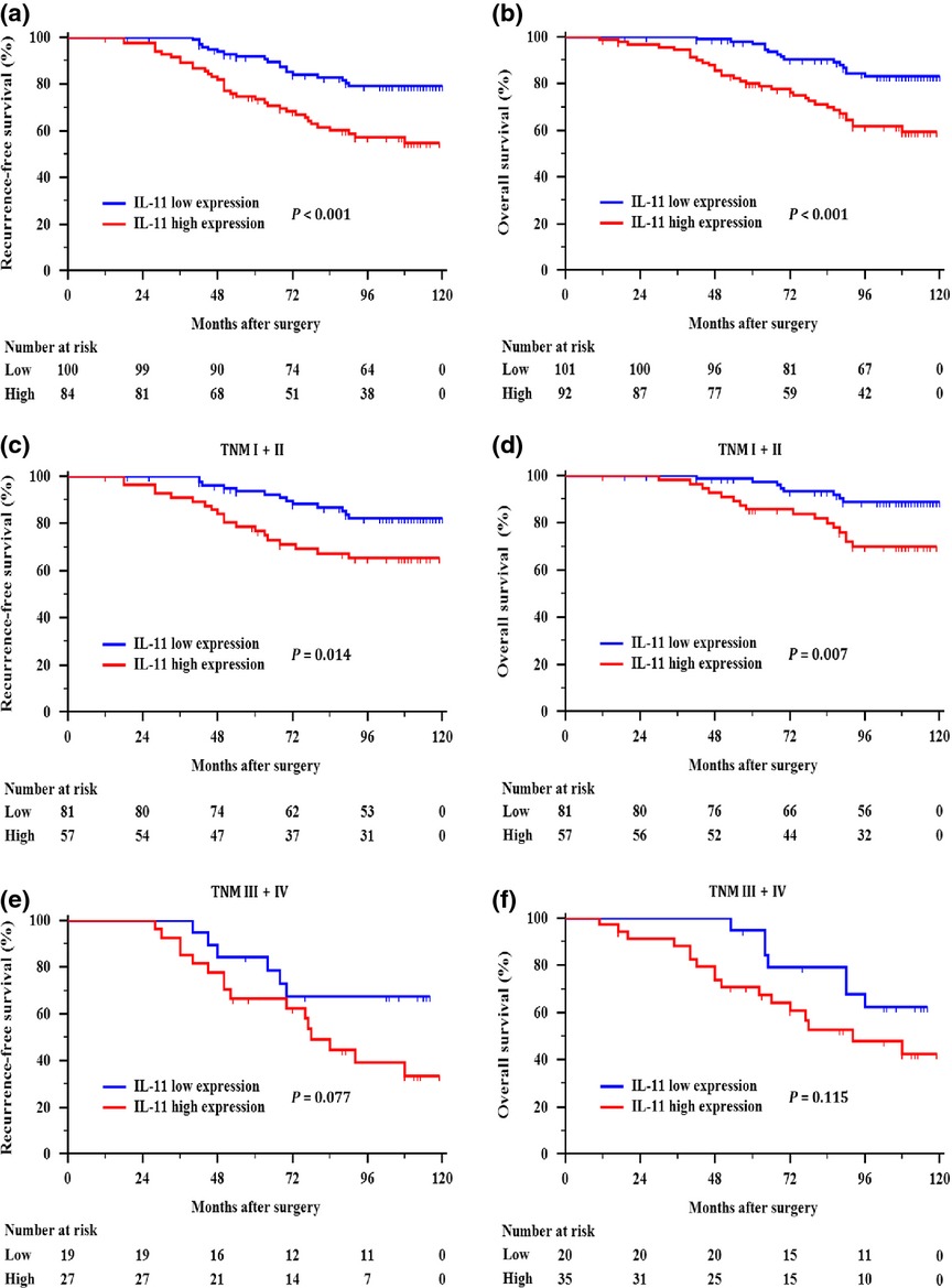 High expression of interleukin-11 is an independent indicator of poor prognosis in clear-cell renal cell carcinoma